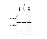 Western analysis of Chk1 protein in the indicated cell lines.  Sheep polyclonal antibody was used at 1:500 dilution.
